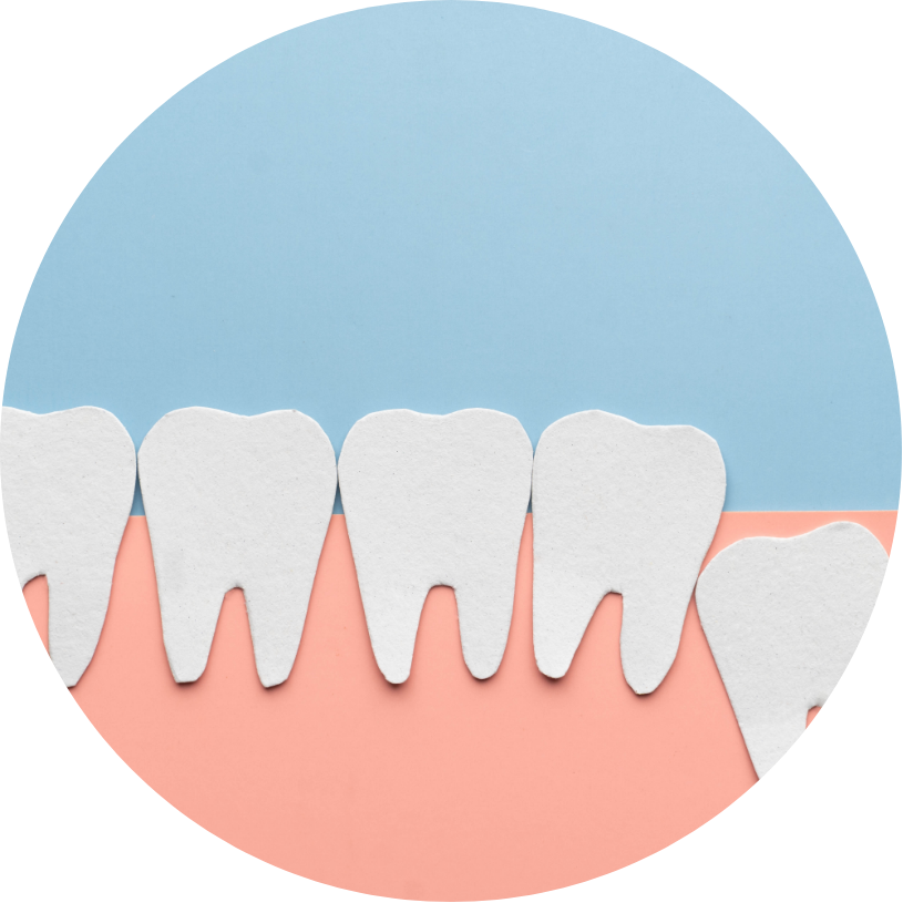 Extractions dentaires & dents de sagesse